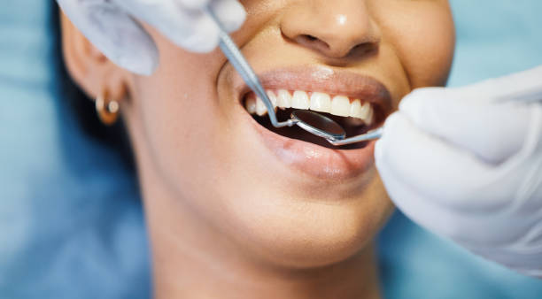 Best Emergency Tooth Extraction in Weleetka, OK