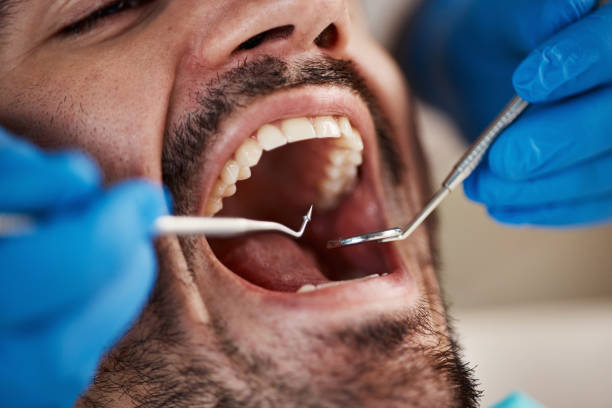 Best Emergency Treatment for Dental Infections or Abscesses in Weleetka, OK