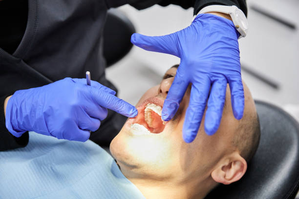 Best Emergency Tooth Extraction in Weleetka, OK
